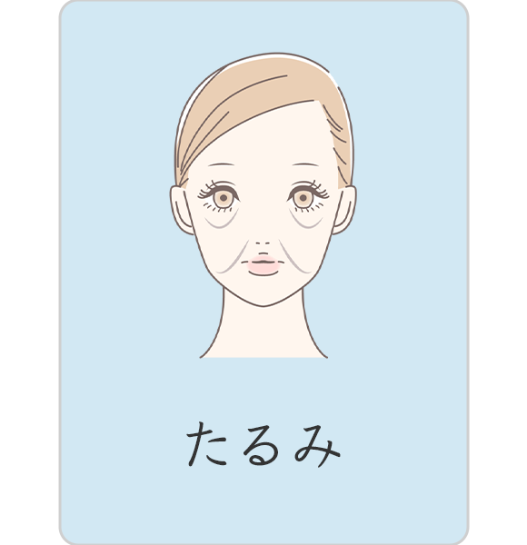 たるみ