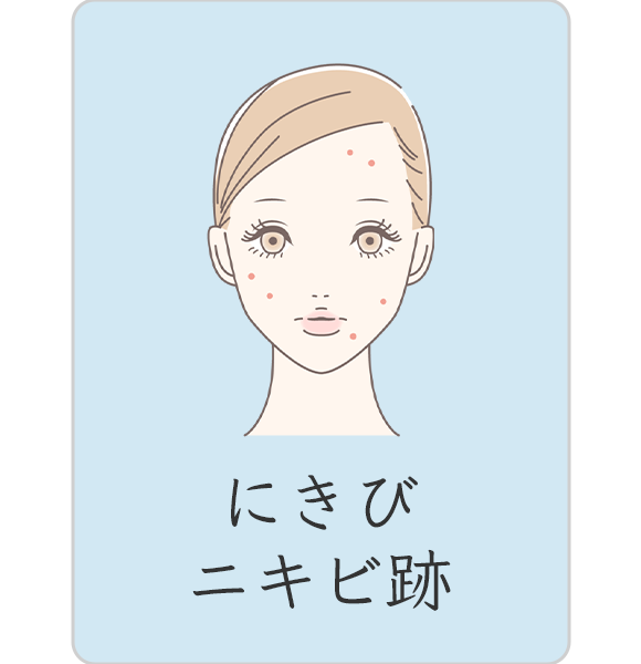 にきび、ニキビ跡