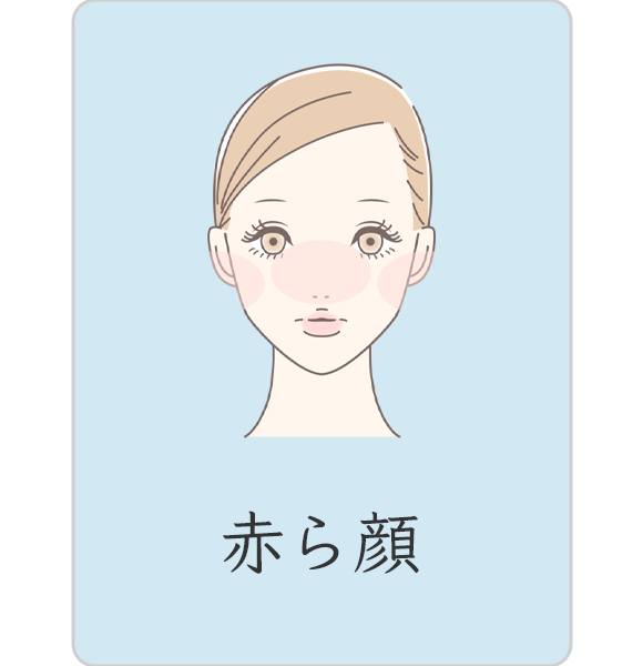 赤ら顔
