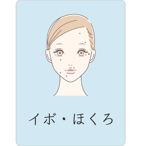 イボ、ほくろ
