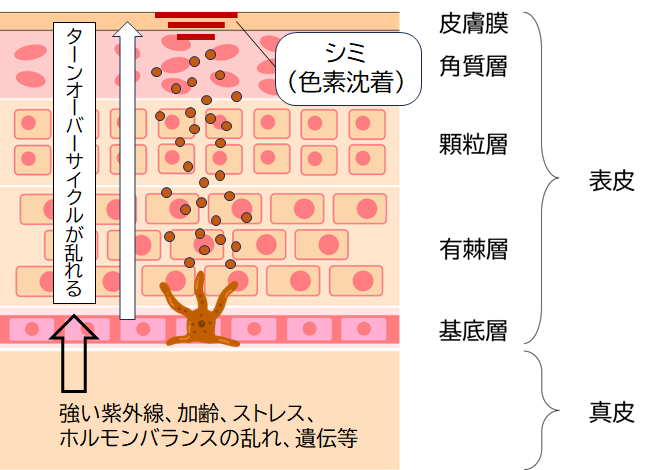 老人性色素班とは？