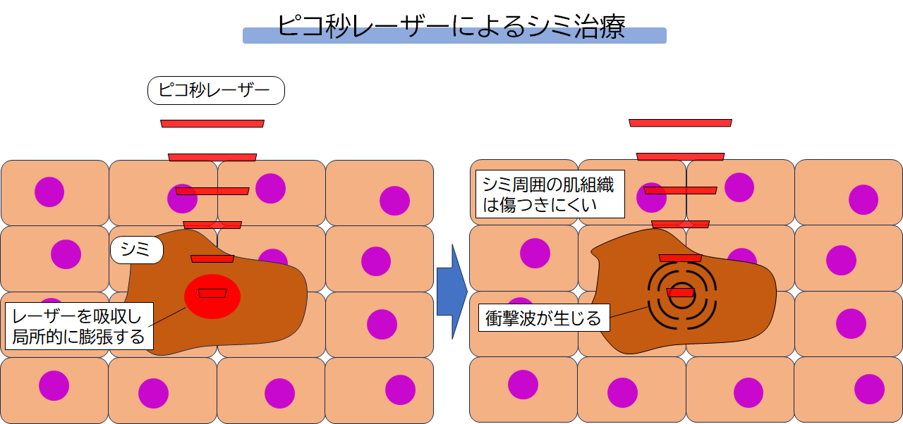 老人性色素班とは？